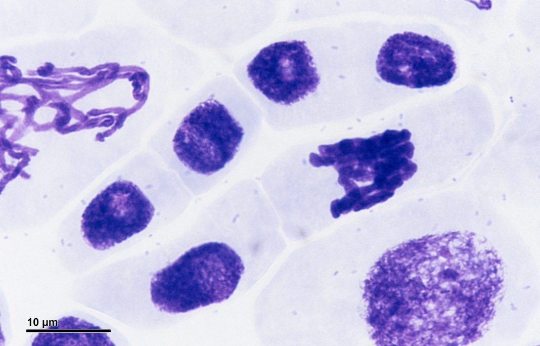 Mitosis of faba cells